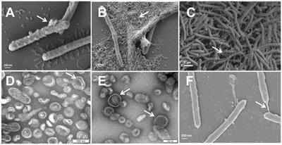 The secretome of the fish pathogen Tenacibaculum maritimum includes soluble virulence-related proteins and outer membrane vesicles